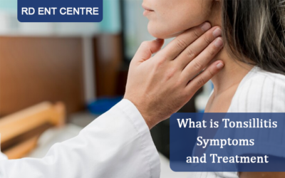 What is Tonsillitis- Symptoms and Treatment